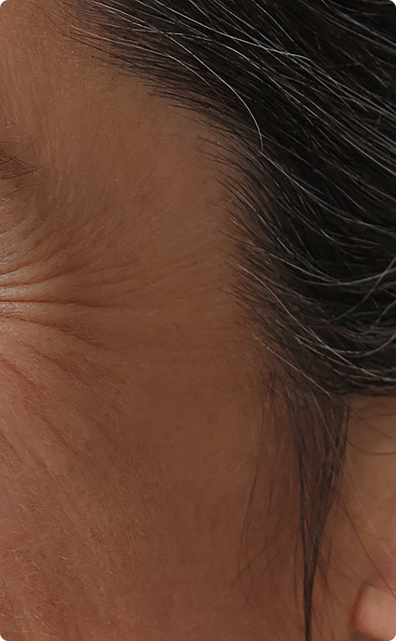 Slower aging